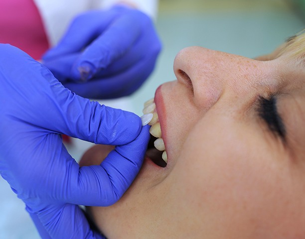 The process of getting veneers is faster and easier than you might think