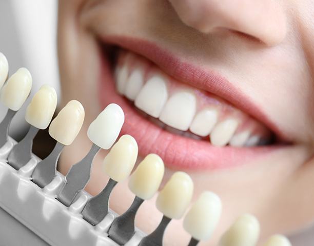 Anyone with healthy teeth and gums who wants whiter teeth is a good candidate for professional whitening