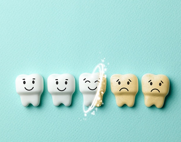 Teeth whitening works by penetrating the pores of your teeth with powerful whitening agents