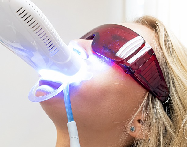 In office whitening can remove eight shades of stains in about an hour