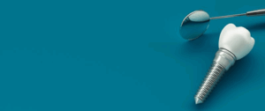 A dental implant and dental tool resting on a blue surface